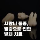 조은턱치과의원 네이버블로그