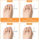 가르망 | 무지외반증 교정기 실리콘 이야발가락교정기