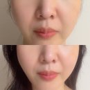 셀비전 쎄라쥬 내돈내산 효과 - 고성능 뷰티디바이스 추천 | 쎄라쥬 언박싱 | 울쎄라 효과 유지하기...