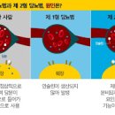 당뇨 제 1형 당뇨 제 2형 당뇨 증상 치료 당뇨 유형과 인슐린과 혈당 이미지