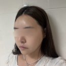신에너지 | 둔산동올타이트리프팅 후기, 자연스러운 얼굴 라인 관리