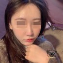 피부뒤집어짐으로 생긴 얼굴여드름과 피부장벽 붉은기 잡기 위한 여드름복합치료 후기(현재는 3회차)