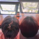 티스테이션일산덕이점 | 일산미용실 추천 아이디헤어덕이점 갈라지는 뒷가마 모류교정펌 후기 전후비교