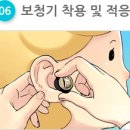 에이스보청기 이미지