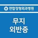 하나연합정형외과 네이버블로그