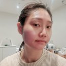 (주)엘아이지시스템 | [강동역피부관리 명소 - 지에스테틱] 트로이필 관리 후기