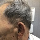 스타키보청기 안동점 | 스타키 보청기 뮤즈iQ 신제품 보청기 구입 후기