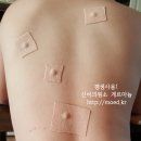 예명한의원 네이버블로그