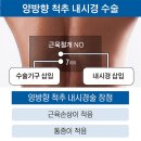 사고로 허리 상태 심각…양방향 내시경수술로 빠르게 회복 이미지