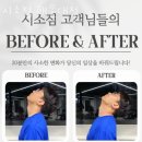 시소짐 네이버블로그