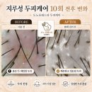도노포레스타 두피케어(산본점)