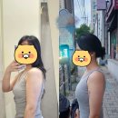 화주기계 | 부산 남천동 웨딩관리맛집 미오레 에스테틱에서 화주테라피 받고온 후기