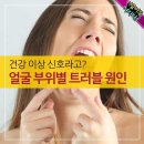 건강 이상 신호라고? 얼굴 부위별 트러블 원인 이미지