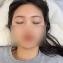 보브인테리어조명 - 화성시 서해로 1399-1 | 청주 사창동 눈썹잘하는곳 리보브로우청주점 붉은잔흔커버 수지기법 솔직후기