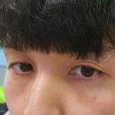 메디큐브의원 | <메디큐브 의원> 강남 신논현점 리쥬란 힐러 후기