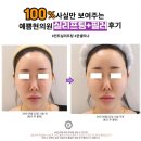 거상환경 | 대전이마실리프팅 안면거상효과 기대해 볼 수 있는 피부과시술 추천, 가격 후기