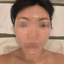 손끝이음 | 매탄동웨딩관리 이음에스테틱 V라인 윤곽 페이셜 예비신부 솔직후기