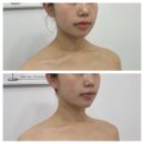 태나 TAENA | 인천등관리 태나뷰티에서 건식 습식 바디관리를 한번에