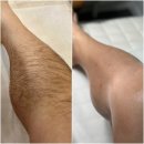 머클왁싱&에스테틱 | [다니에르 리뷰] 선릉왁싱 머클왁싱 강남왁싱 다리왁싱 후기