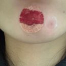 척바른신경외과의원 이미지