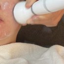 기가메디칼 | [서울] 보름달뷰티 서울 강남 신논현역 여드름 압출 피부관리 후기