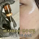 더마리턴5 | 망우동 에스테티아 예신 피부관리 더마리젠 리턴 솔루션 후 변화
