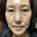 인셀덤 화장품 한달 쓴 리얼 후기
