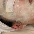 진심 에스테틱 | 방배 피부관리 자월에스테틱 아크네힐러1 얼굴케어 진심 후기
