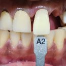 중앙치과기공소 이미지