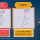건강약손 이미지
