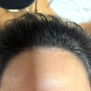 김뷰티헤어 | 대구 동구 두피문신 ‘홍화뷰티’| 가르마 탈모 커버부터 헤어라인 리터치까지 자연스러운 SMP 후기