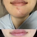함희정성형외과의원 네이버블로그