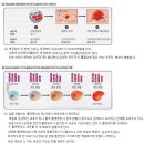 암의 발생원인과 치료 이미지