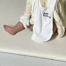 아기 화상 물집, 아기 2도 화상 대처법, 아기 저온 화상 병원기록, 인천 화상병원 찬솔 외과, 심재성...