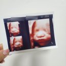 [임신기록] 29주차 입체초음파 성공, 아기 머리카락 발견💕