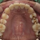 뉴치과기공소 이미지