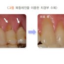 상아치과재료 이미지