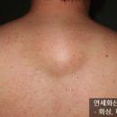 연세화산외과 이미지