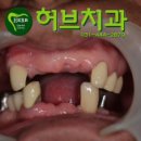 세계광택 이미지