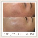 상남동211 | 창원에스테틱 르네아바이더랩 재방문으로 상남동 얼굴열 안면홍조와 좁쌀여드름 끊어낸 후기