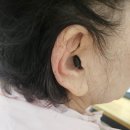엣지안경 | 부안보청기. 스타키 엣지 CIC 보청기 70대 여성 사용후기