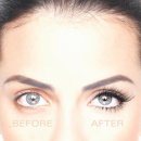 하이얀피부샵 이미지