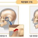 턱이 아파요 이유 턱이 아플 때 턱관절 통증 염증 소리 원인 이미지