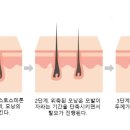 인동36길-11 이미지