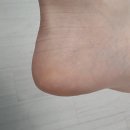 미인케어 | 여름철 촉촉한 발 관리! 다이소 꿀광보습 팩미인 풋케어 팩 후기!