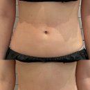 태크니끄 이미지