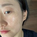 신천중앙약국 | 얀클리닉 슬렌코주사 리뷰, 코조각주사 가격