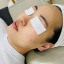 평택 여드름 압출 케어 전문 선새김에스테틱, 출산 후 피부관리 후기