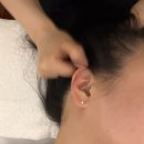 6234 | [피부관리] 철산 피부관리샵 작은얼굴관리 솔직후기(전후 비교 있음)