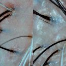 닥터큐피부탈모전문샵 | 명지두피관리 올가드림뷰티 명지점 ㅣ 명지에스테틱 부산두피관리